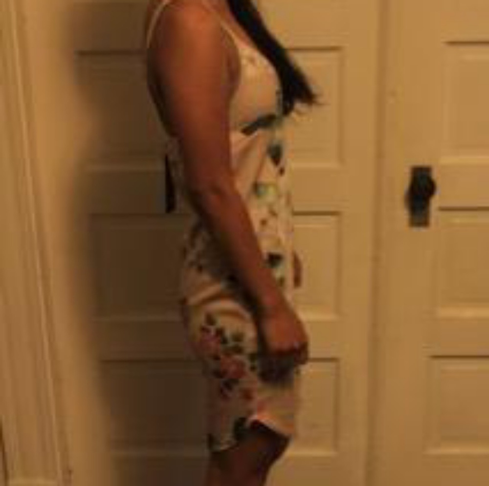 Dress - Picture 2 of 4